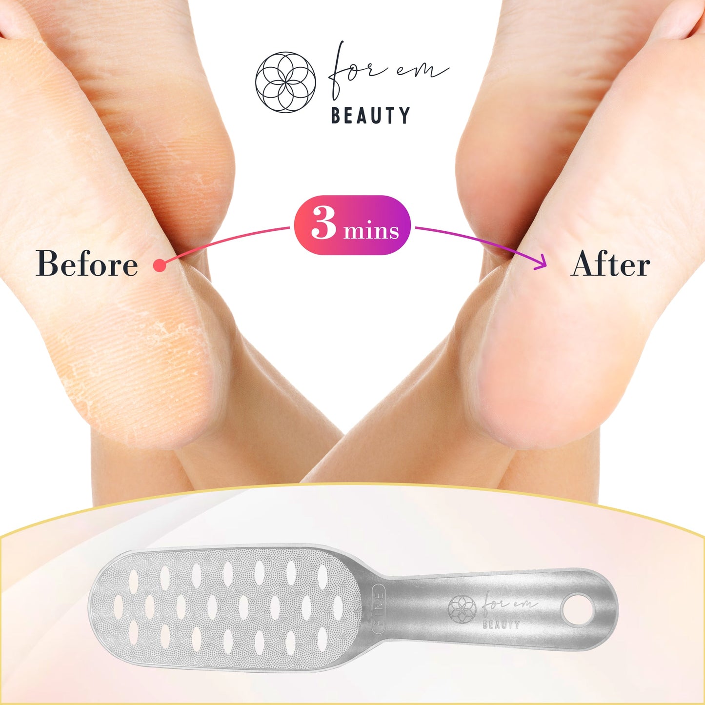 Foot File Callus Remover Full Stainless Steel Double-sided Autoclave Sterilizes Compatible
